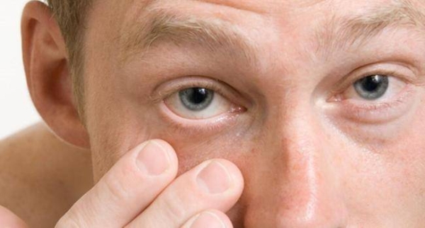 Красные, зудящие глаза: аллергия или инфекция